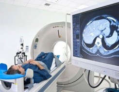  السعودية اليوم - ابتكار علاج غير جراحي يفتح الأمل لمرضى الورم الأرومي الدبقي