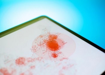  السعودية اليوم - بكتيريا نادرة تتخفى داخل منشآت ناسا واحتمال وصولها إلى المريخ يثير القلق