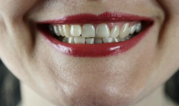 تطوير عقار هو الأول من نوعه يساعد على انبات أسنان جديدة