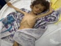  السعودية اليوم - خطأ من الذكاء الاصطناعي باتهام نائب فرنسي بنشر صورة غير دقيقة حول المجاعة في غزّة